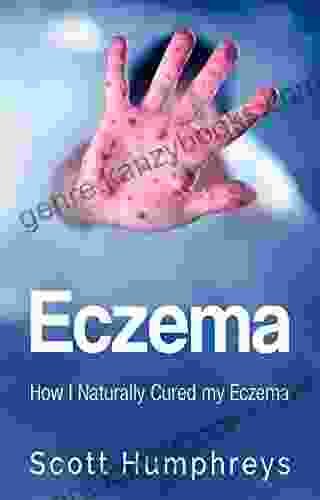 Eczema: How I Naturally Cured My Eczema